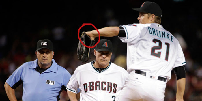 Diamondbacks' pitcher Zack Greinke shows palm